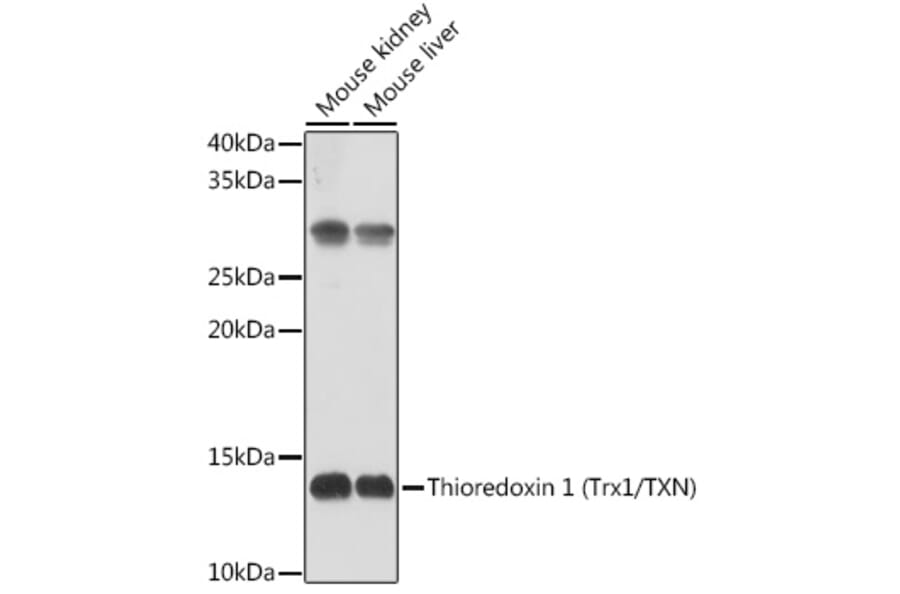 Western Blot - Anti-Thioredoxin / TRX Antibody (A88106) - Antibodies.com