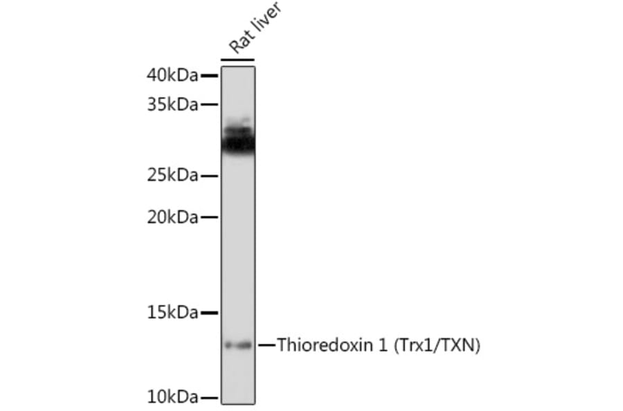 Western Blot - Anti-Thioredoxin / TRX Antibody (A88106) - Antibodies.com