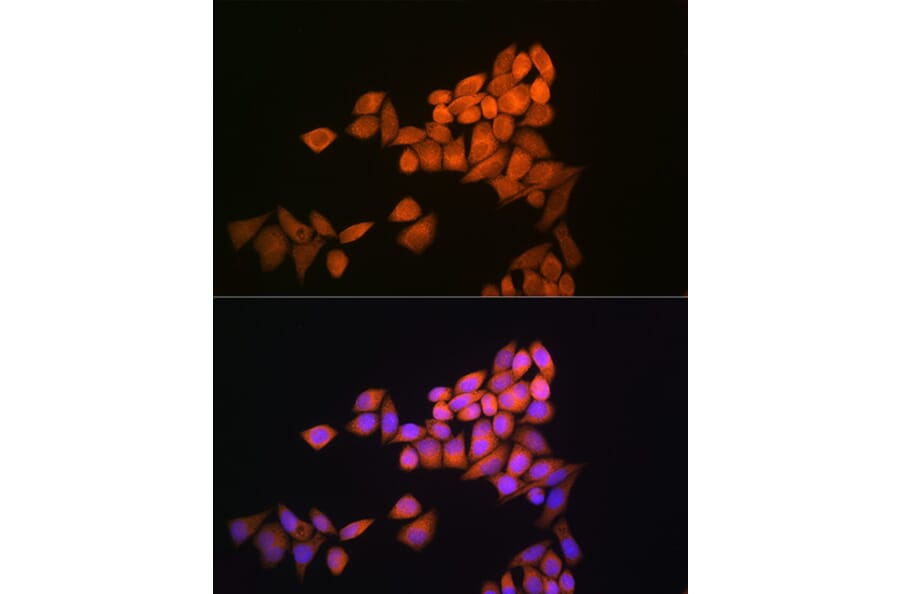 Immunofluorescence - Anti-Thioredoxin / TRX Antibody (A88106) - Antibodies.com