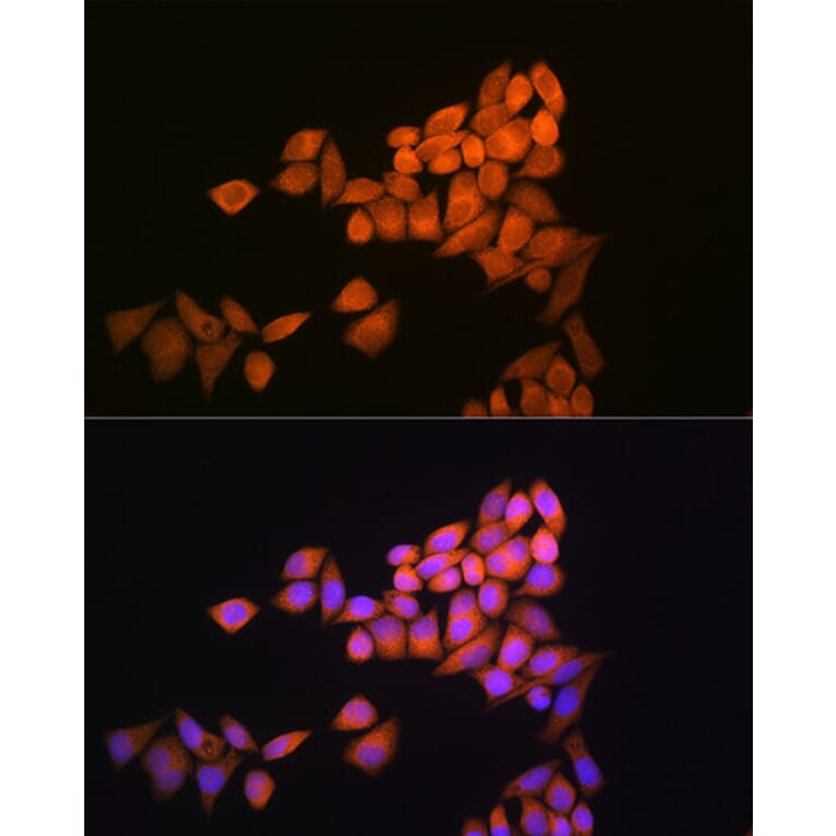 Immunofluorescence - Anti-Thioredoxin / TRX Antibody (A88106) - Antibodies.com