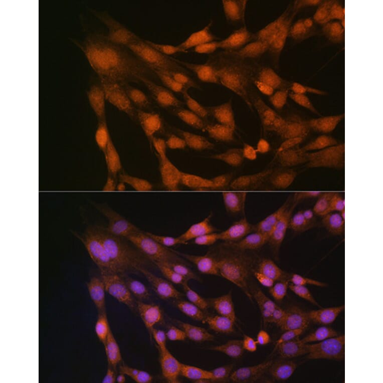 Immunofluorescence - Anti-Thioredoxin / TRX Antibody (A88106) - Antibodies.com