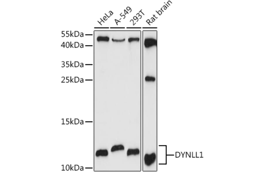Western Blot - Anti-DYNLL1/PIN Antibody (A88107) - Antibodies.com