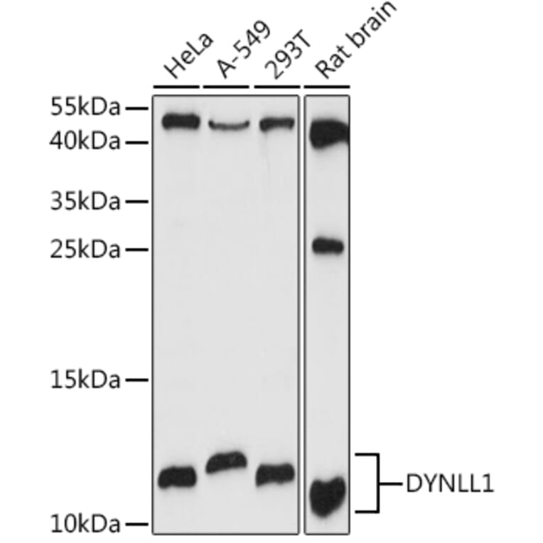 Western Blot - Anti-DYNLL1/PIN Antibody (A88107) - Antibodies.com