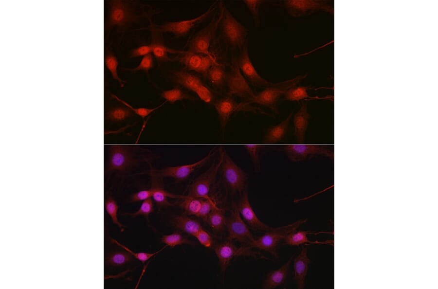 Immunofluorescence - Anti-DYNLL1/PIN Antibody (A88107) - Antibodies.com