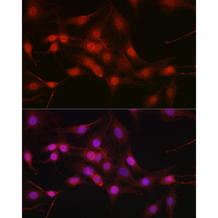 Immunofluorescence - Anti-DYNLL1/PIN Antibody (A88107) - Antibodies.com