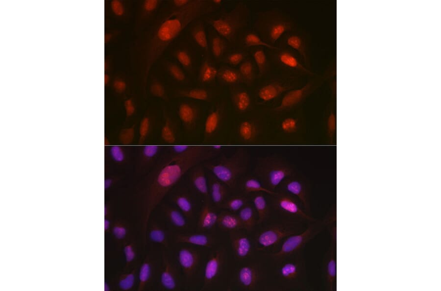 Immunofluorescence - Anti-DYNLL1/PIN Antibody (A88107) - Antibodies.com