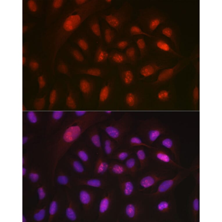 Immunofluorescence - Anti-DYNLL1/PIN Antibody (A88107) - Antibodies.com