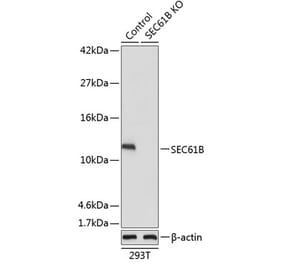 Western Blot - Anti-SEC61B Antibody (A88108) - Antibodies.com