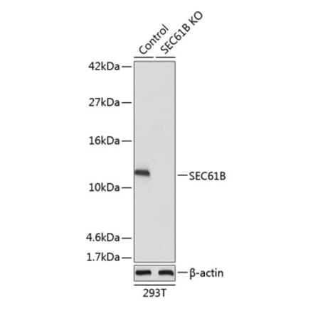 Western Blot - Anti-SEC61B Antibody (A88108) - Antibodies.com