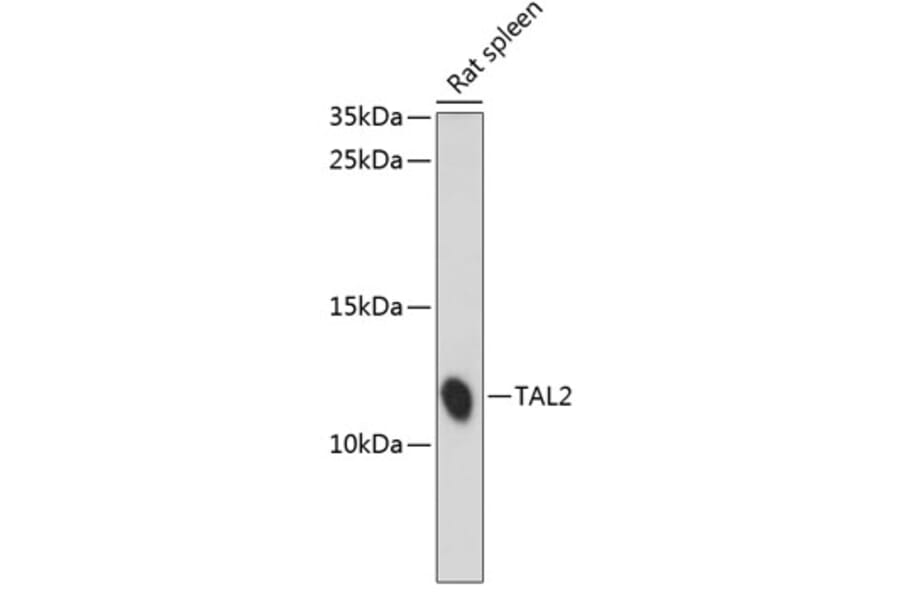 Western Blot - Anti-TAL2 Antibody (A88109) - Antibodies.com