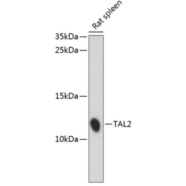 Western Blot - Anti-TAL2 Antibody (A88109) - Antibodies.com