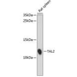 Western Blot - Anti-TAL2 Antibody (A88109) - Antibodies.com