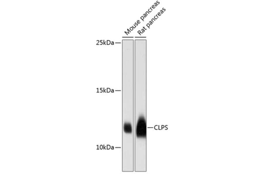 Western Blot - Anti-CLPS Antibody (A88110) - Antibodies.com
