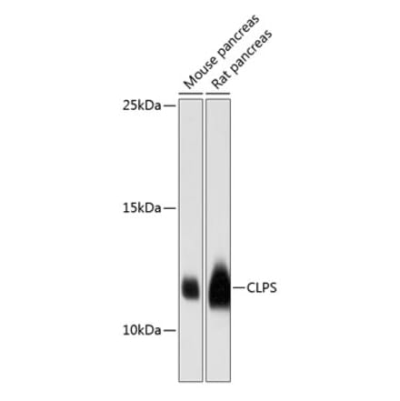 Western Blot - Anti-CLPS Antibody (A88110) - Antibodies.com
