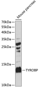 Western blot analysis of extracts of mouse pancreas, using Anti-TYROBP Antibody (A14794) at 1:3000 dilution.
Secondary antibody: Goat Anti-Rabbit IgG (H+L) (HRP) (AS014) at 1:10,000 dilution.
Lysates / proteins: 25µg per lane.
Blocking buffer: 3% non-fat dry milk in TBST.
Detection: ECL Basic Kit (RM00020).
Exposure time: 90s.