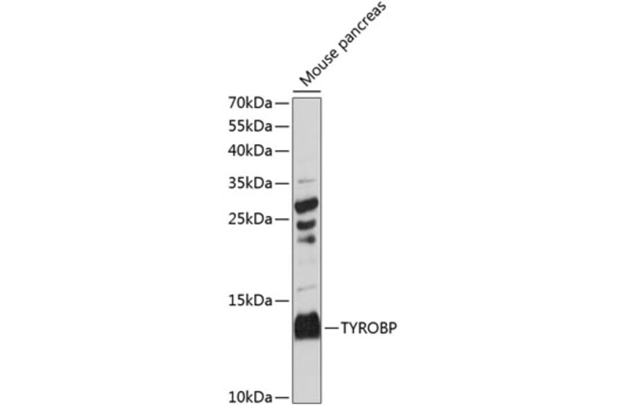 Western Blot - Anti-DAP12 Antibody (A88111) - Antibodies.com