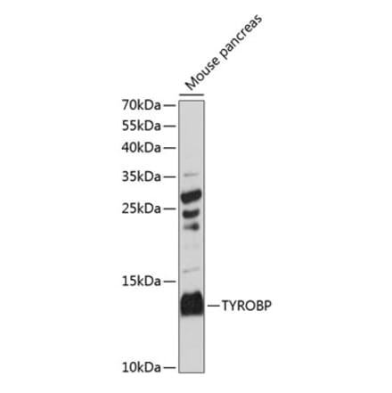 Western Blot - Anti-DAP12 Antibody (A88111) - Antibodies.com