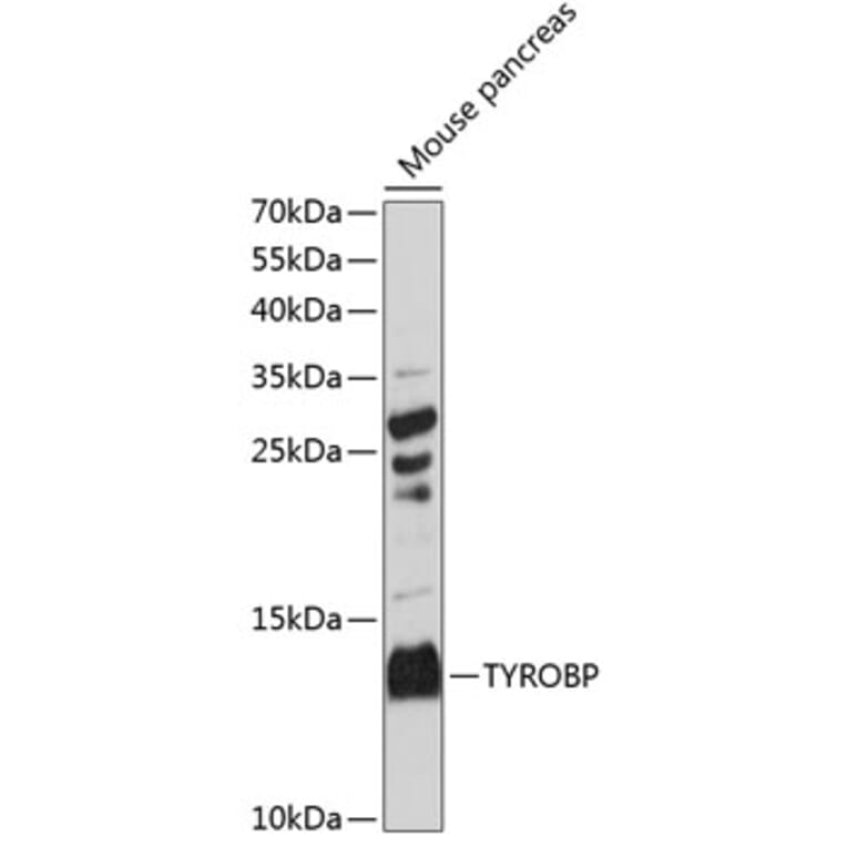 Western Blot - Anti-DAP12 Antibody (A88111) - Antibodies.com