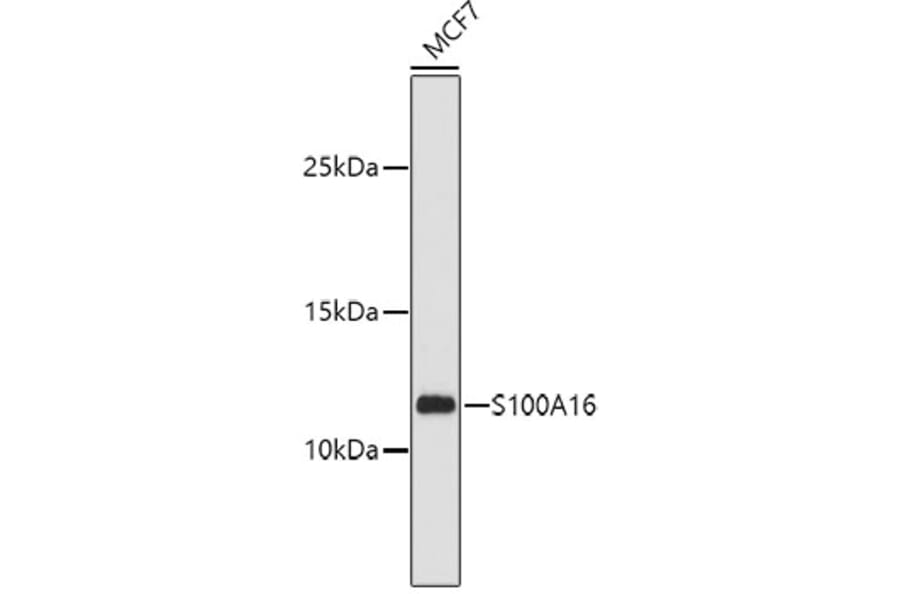 Western Blot - Anti-S100A16 Antibody (A12345) - Antibodies.com