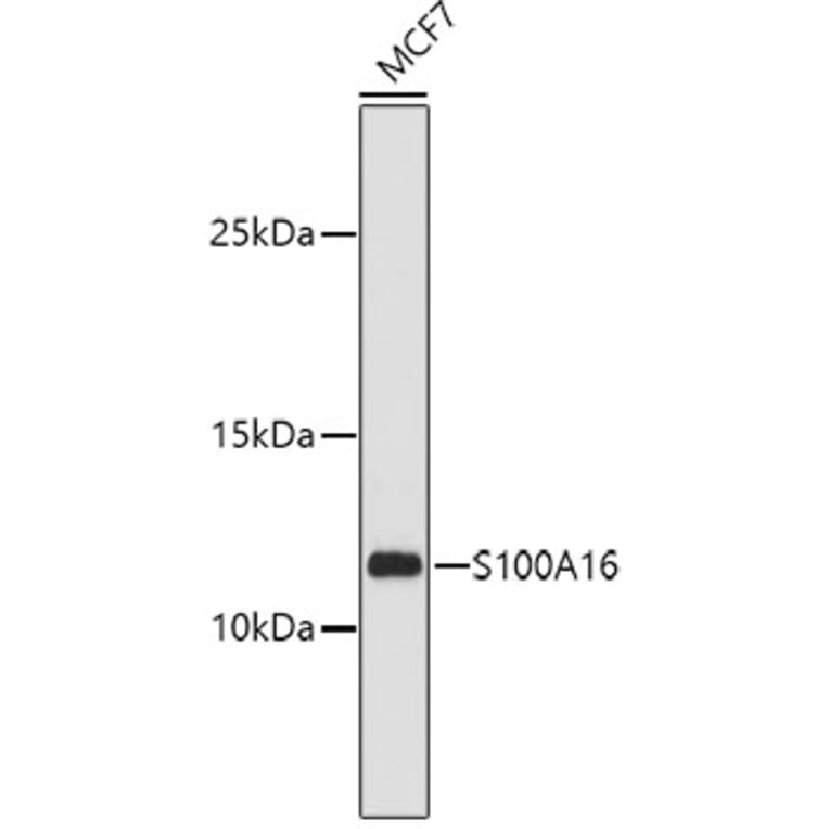 Western Blot - Anti-S100A16 Antibody (A12345) - Antibodies.com