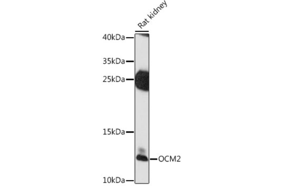 Western Blot - Anti-OCM2 Antibody (A88113) - Antibodies.com