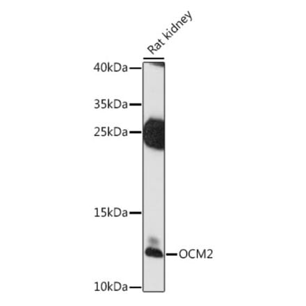 Western Blot - Anti-OCM2 Antibody (A88113) - Antibodies.com