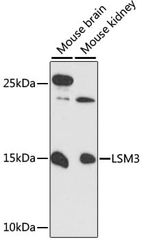 Western blot analysis of extracts of various cell lines, using Anti-LSM3 Antibody (A13189) at 1:3000 dilution.
Secondary antibody: Goat Anti-Rabbit IgG (H+L) (HRP) (AS014) at 1:10,000 dilution.
Lysates / proteins: 25µg per lane.
Blocking buffer: 3% non-fat dry milk in TBST.
Detection: ECL Enhanced Kit (RM00021).
Exposure time: 90s.
