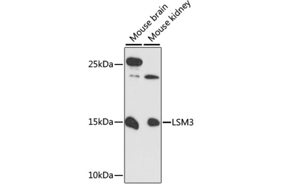 Western Blot - Anti-LSM3 Antibody (A88114) - Antibodies.com