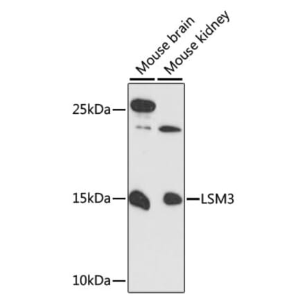 Western Blot - Anti-LSM3 Antibody (A88114) - Antibodies.com