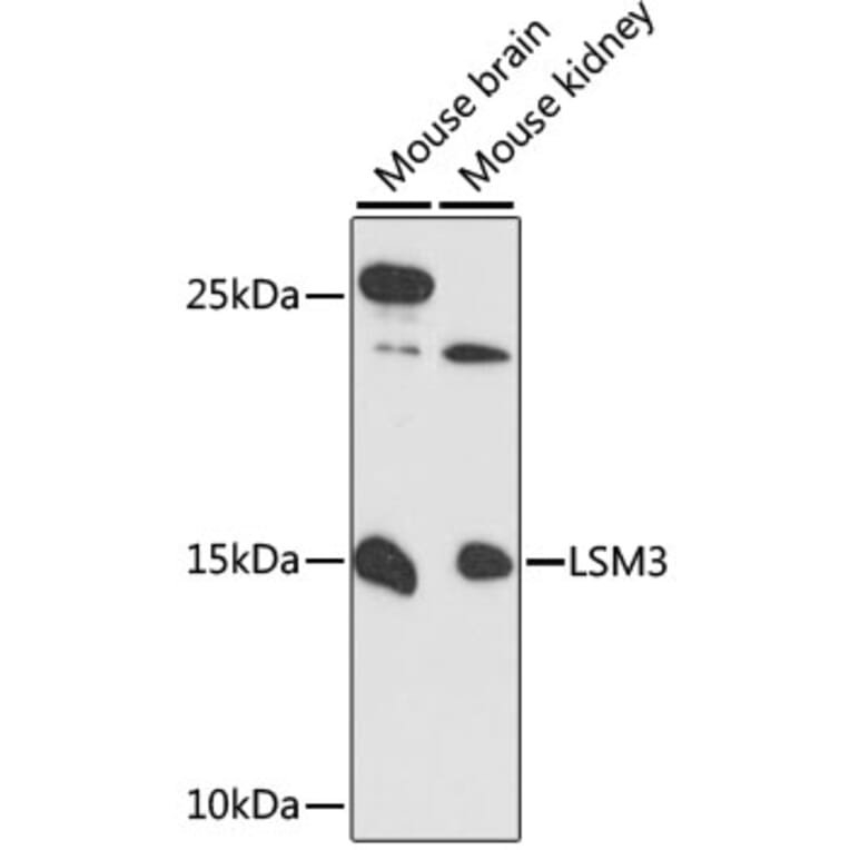 Western Blot - Anti-LSM3 Antibody (A88114) - Antibodies.com