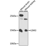 Western Blot - Anti-LSM3 Antibody (A88114) - Antibodies.com