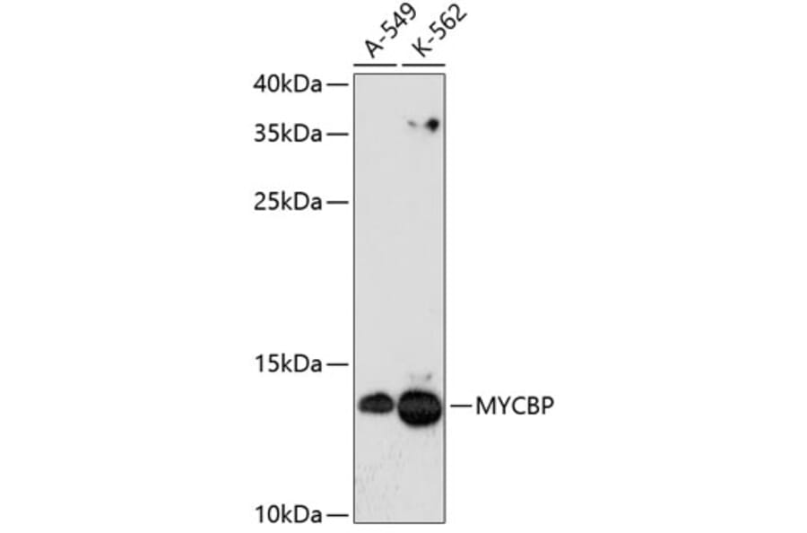 Western Blot - Anti-AMY-1 Antibody (A88115) - Antibodies.com