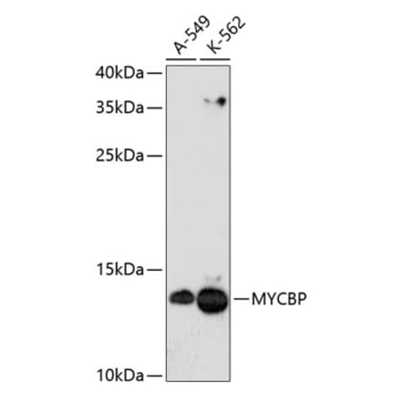 Western Blot - Anti-AMY-1 Antibody (A88115) - Antibodies.com
