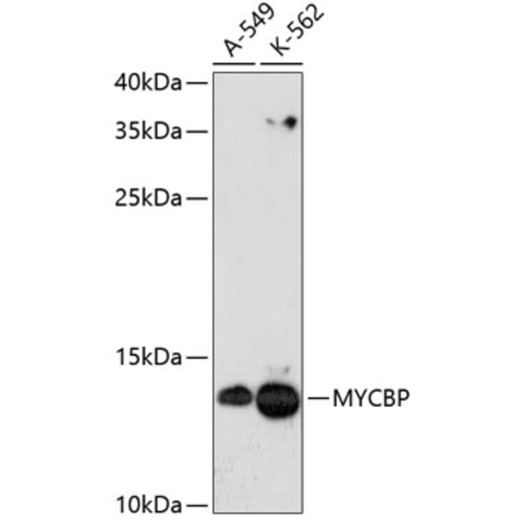 Western Blot - Anti-AMY-1 Antibody (A88115) - Antibodies.com