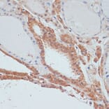 Immunohistochemistry - Anti-AMY-1 Antibody (A88115) - Antibodies.com