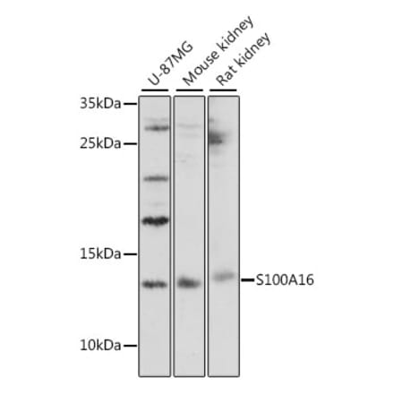 Western Blot - Anti-S100A16 Antibody (A88116) - Antibodies.com