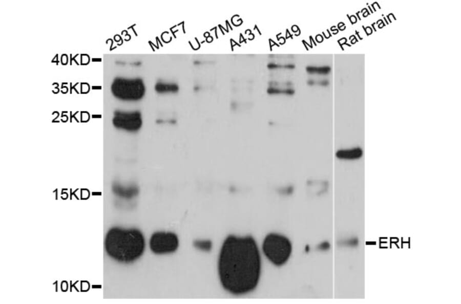 Western Blot - Anti-ERH Antibody (A12381) - Antibodies.com