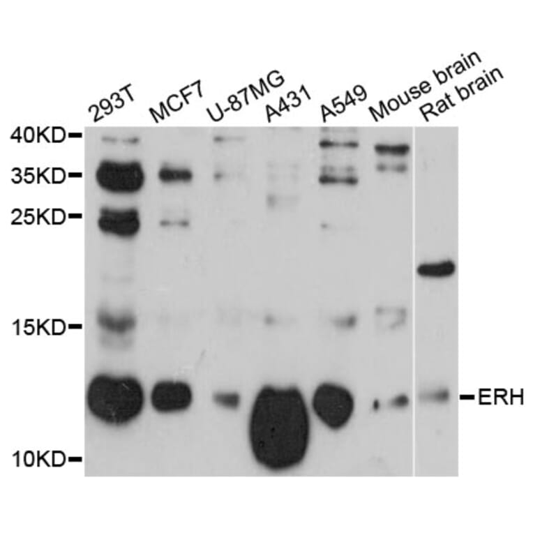 Western Blot - Anti-ERH Antibody (A12381) - Antibodies.com