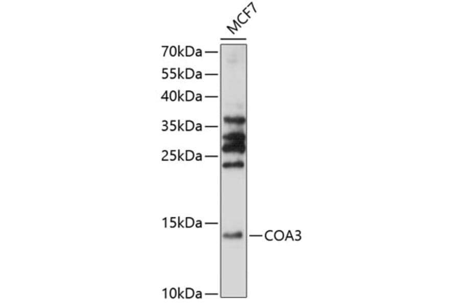Western Blot - Anti-CCDC56 Antibody (A88118) - Antibodies.com