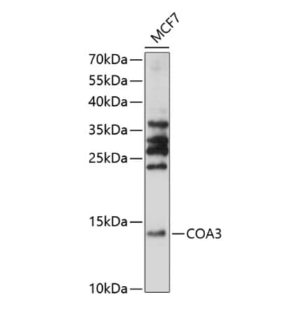 Western Blot - Anti-CCDC56 Antibody (A88118) - Antibodies.com