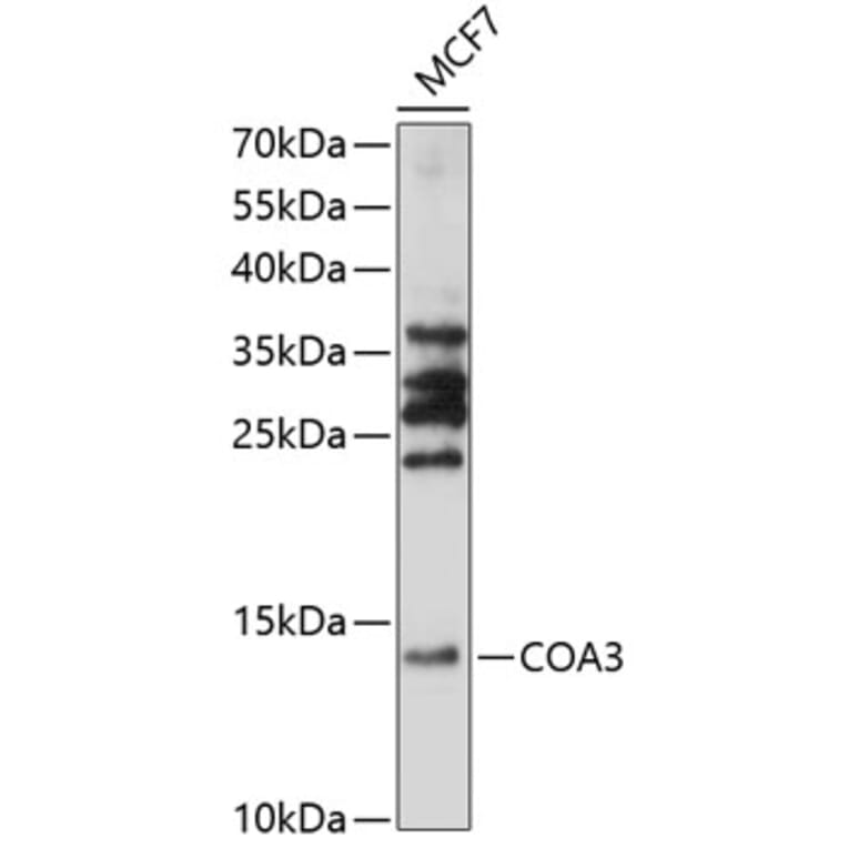 Western Blot - Anti-CCDC56 Antibody (A88118) - Antibodies.com