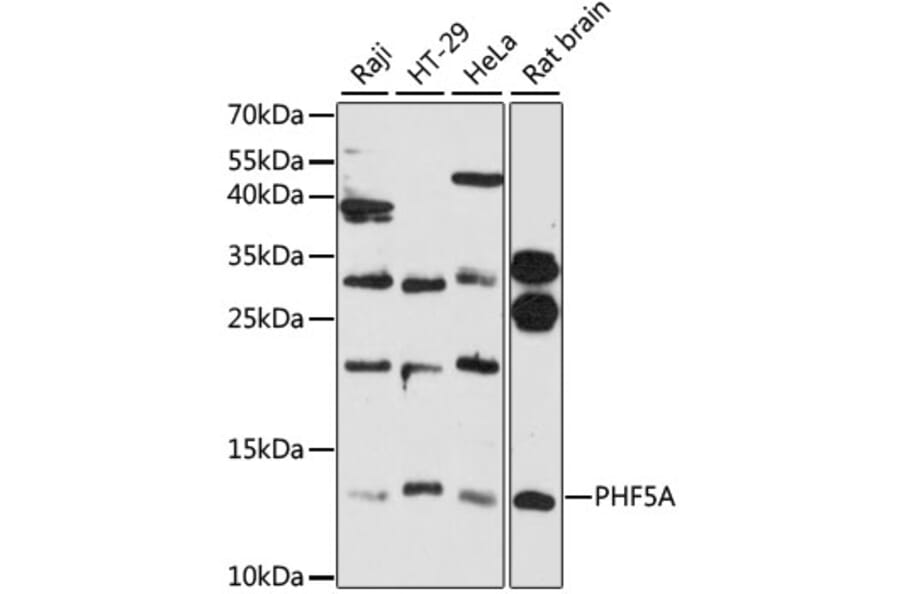 Western Blot - Anti-PHF5A Antibody (A12678) - Antibodies.com