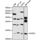 Western Blot - Anti-PHF5A Antibody (A12678) - Antibodies.com