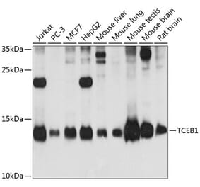 Western Blot - Anti-Elongin-C Antibody (A88120) - Antibodies.com