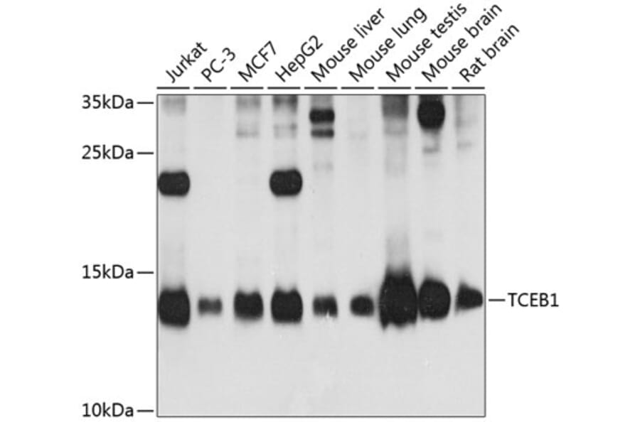 Western Blot - Anti-Elongin-C Antibody (A88120) - Antibodies.com
