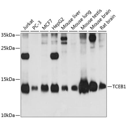 Western Blot - Anti-Elongin-C Antibody (A88120) - Antibodies.com