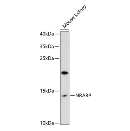 Western Blot - Anti-NRARP Antibody (A88121) - Antibodies.com