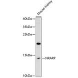Western Blot - Anti-NRARP Antibody (A88121) - Antibodies.com