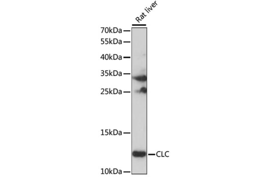 Western Blot - Anti-CLC Antibody (A15264) - Antibodies.com