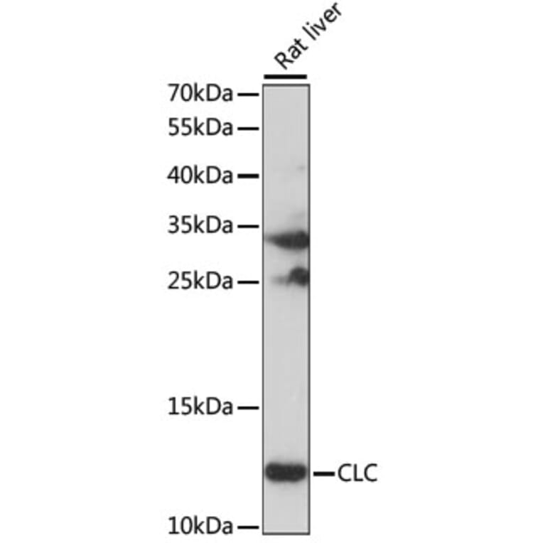 Western Blot - Anti-CLC Antibody (A15264) - Antibodies.com
